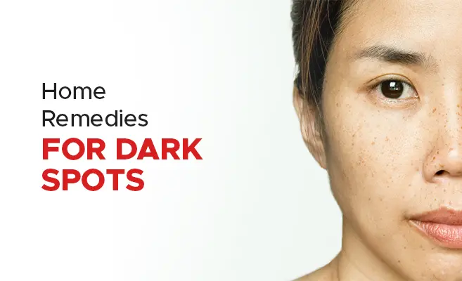 General Tips for Dark Spot Reduction