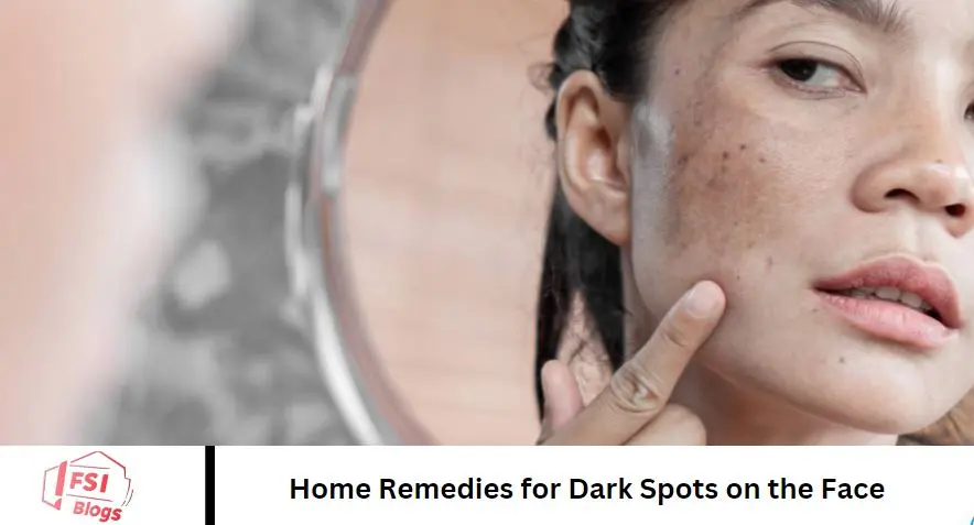 Home Remedies for Dark Spots on the Face